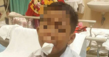 Boy Force To Cut Off Own Tongue By Bullies Boy Force To Cut Off Own Tongue By Bullies