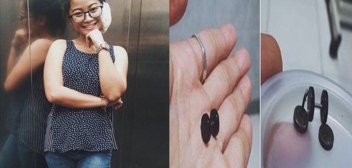 FILIPINO GIRL GET EAR INFECTION AND HAD AN OPERATION DONE AFTER WEARING CHEAP EARRINGS!